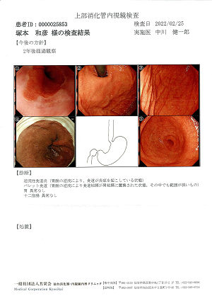 上部消化管内視鏡検査結果 2022.02.25