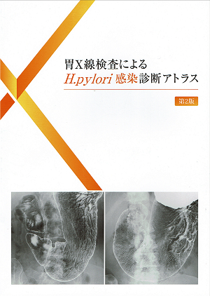胃X線検査によるH.pylori感染診断アトラス